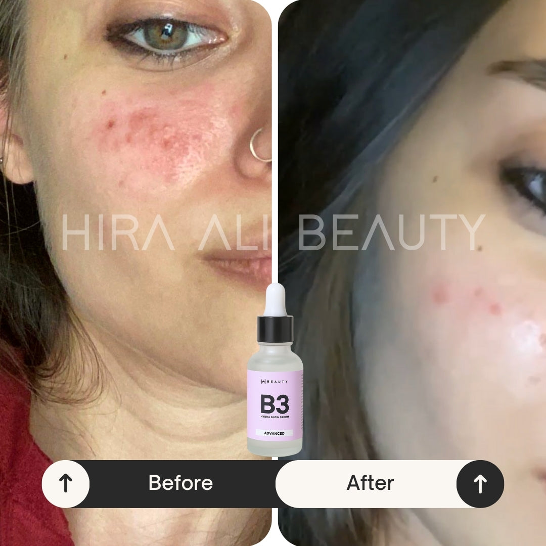 Brightening Protection Bundle