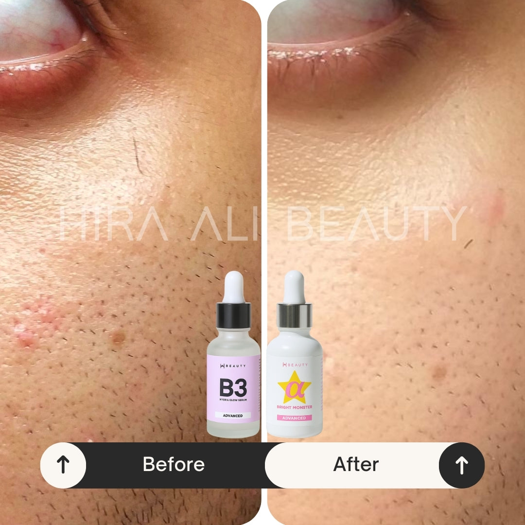 Brightening Protection Bundle