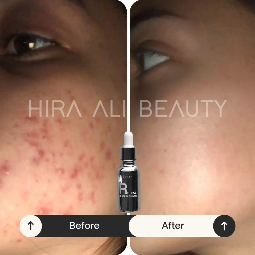 Age Reversal Trio - Hira Ali 