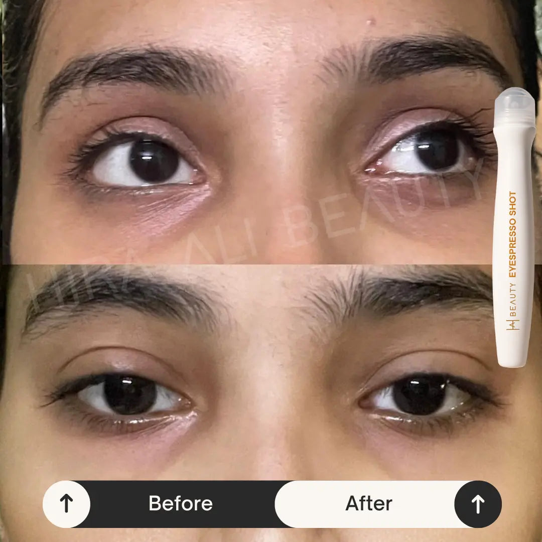Eyespresso Shot 4% Coffee Extract+Vit K - Hira Ali 