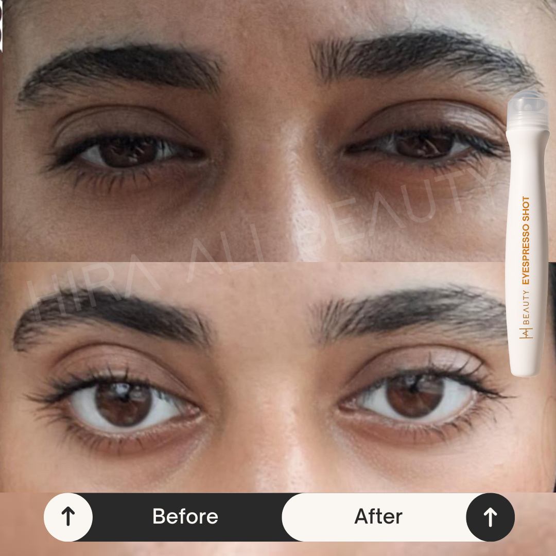 Eyespresso Shot 4% Coffee Extract+Vit K - Hira Ali 