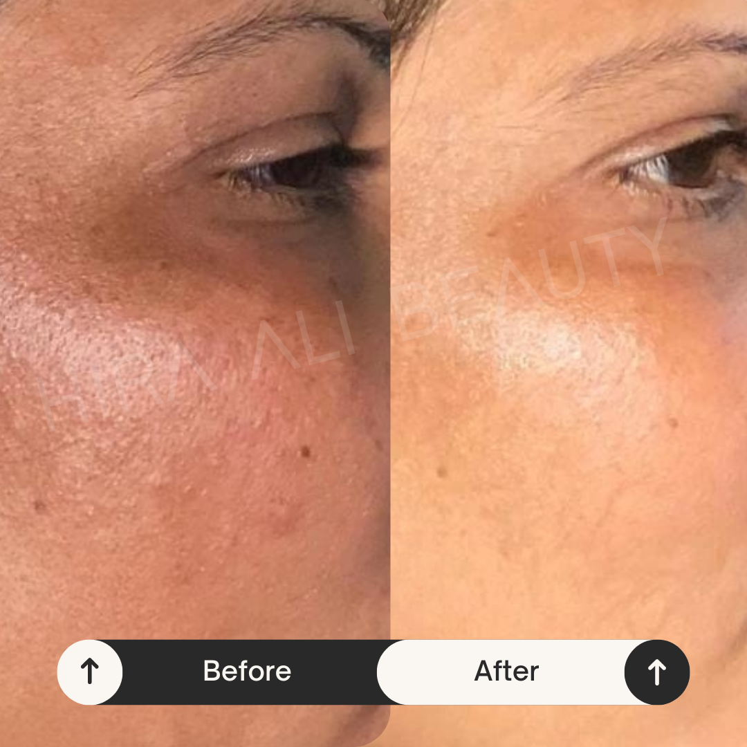 Bright Monster Serum - Alpha Arbutin 2% + HA - Hira Ali 