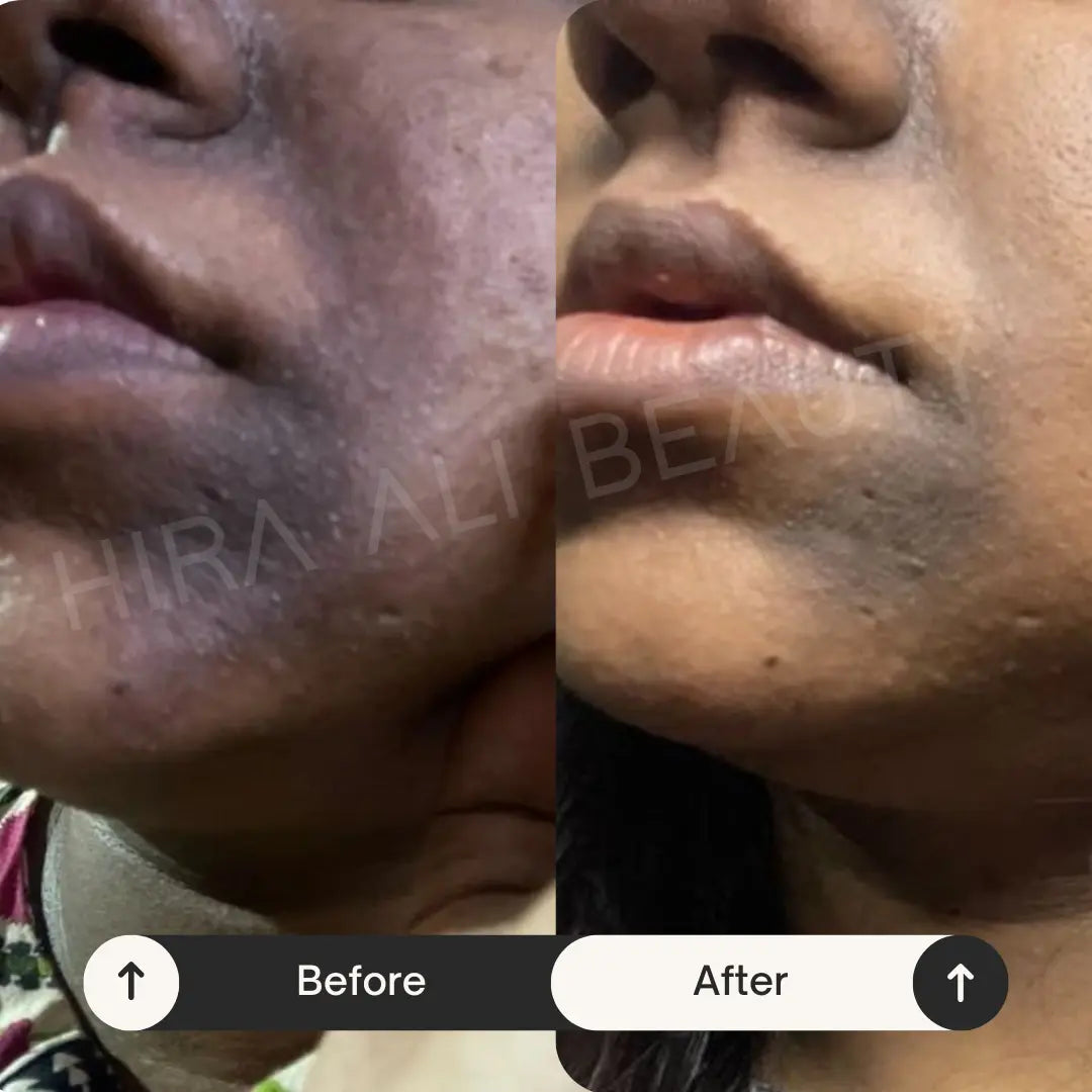Bright Monster Serum - Alpha Arbutin 2% + HA - Hira Ali 