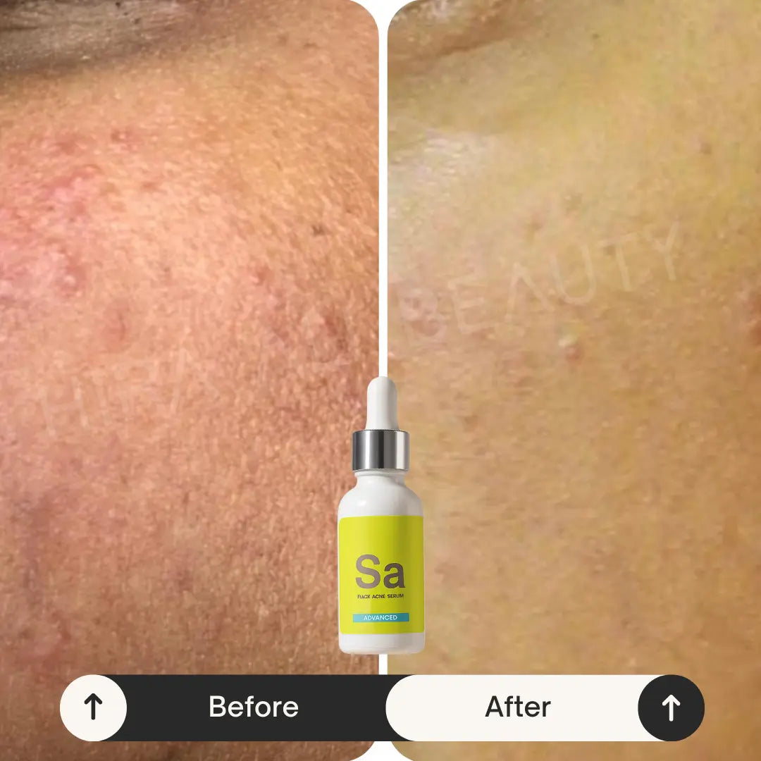 Exfoliation Duo - Hira Ali 
