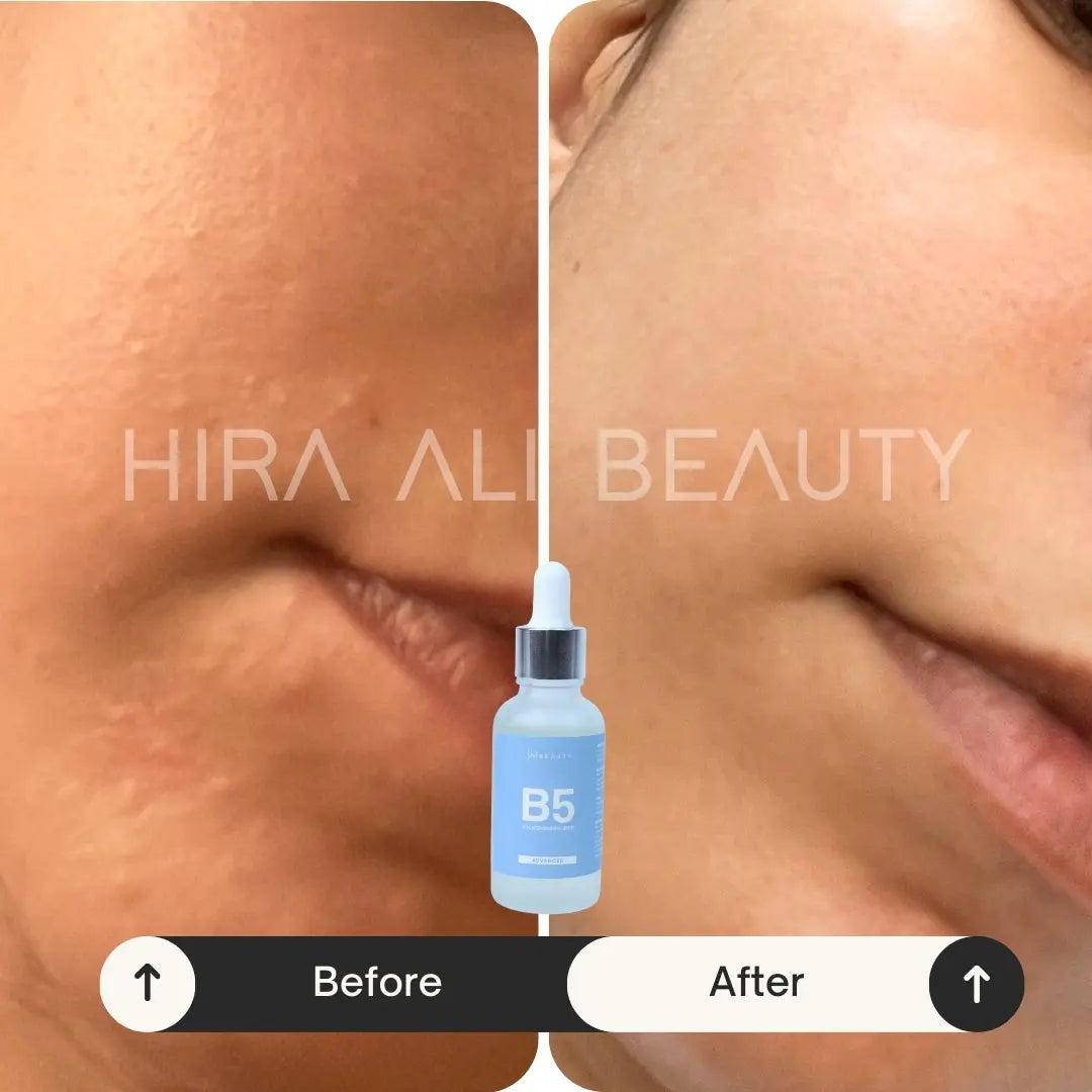 Age Reversal Trio - Hira Ali 