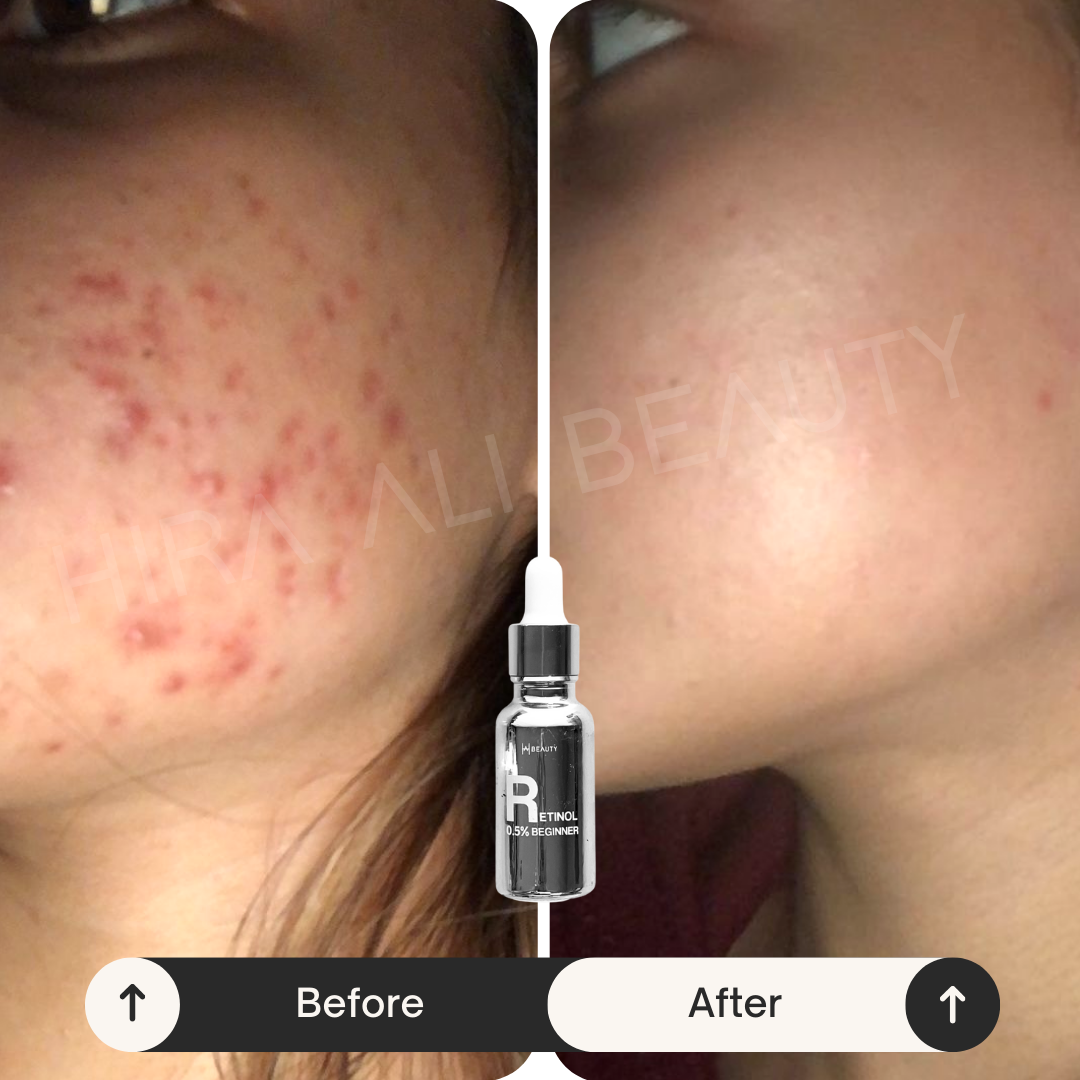 Retinol Starter Serum 0.5% - Hira Ali 