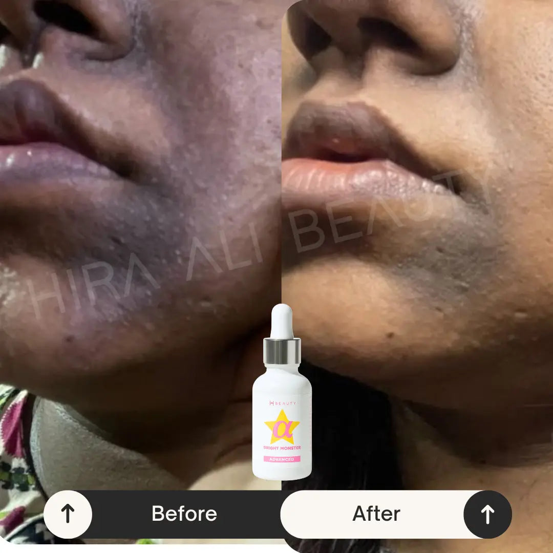 Eyes + Skin Brightening Duo - Hira Ali 