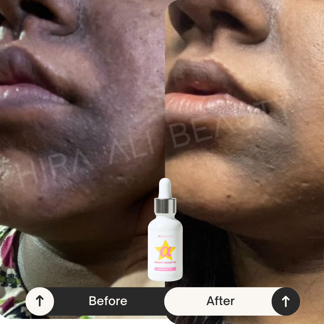 Eyes + Skin Brightening Duo - Hira Ali 