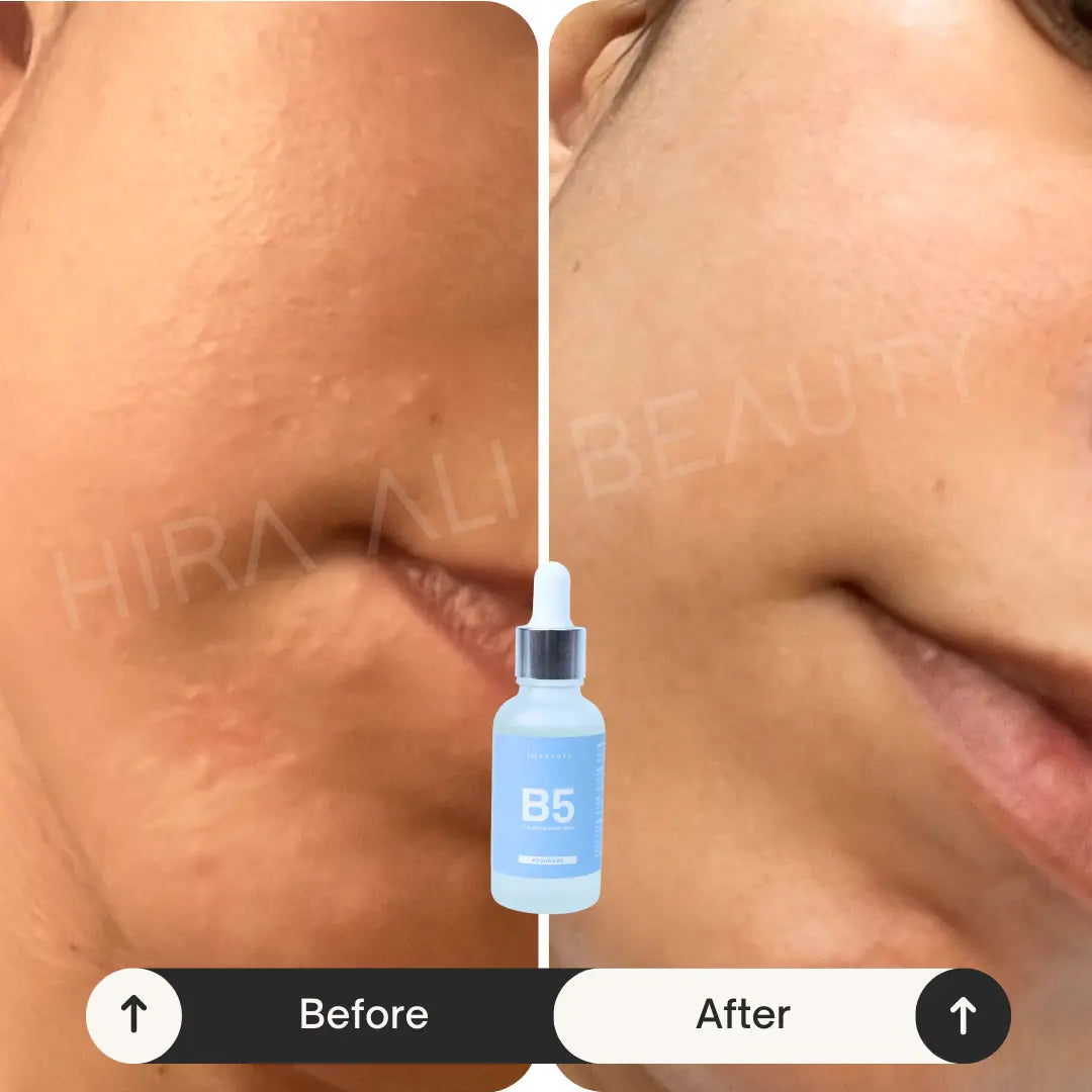 Collagen Booster Serum - Vit B5 + HA - Hira Ali 