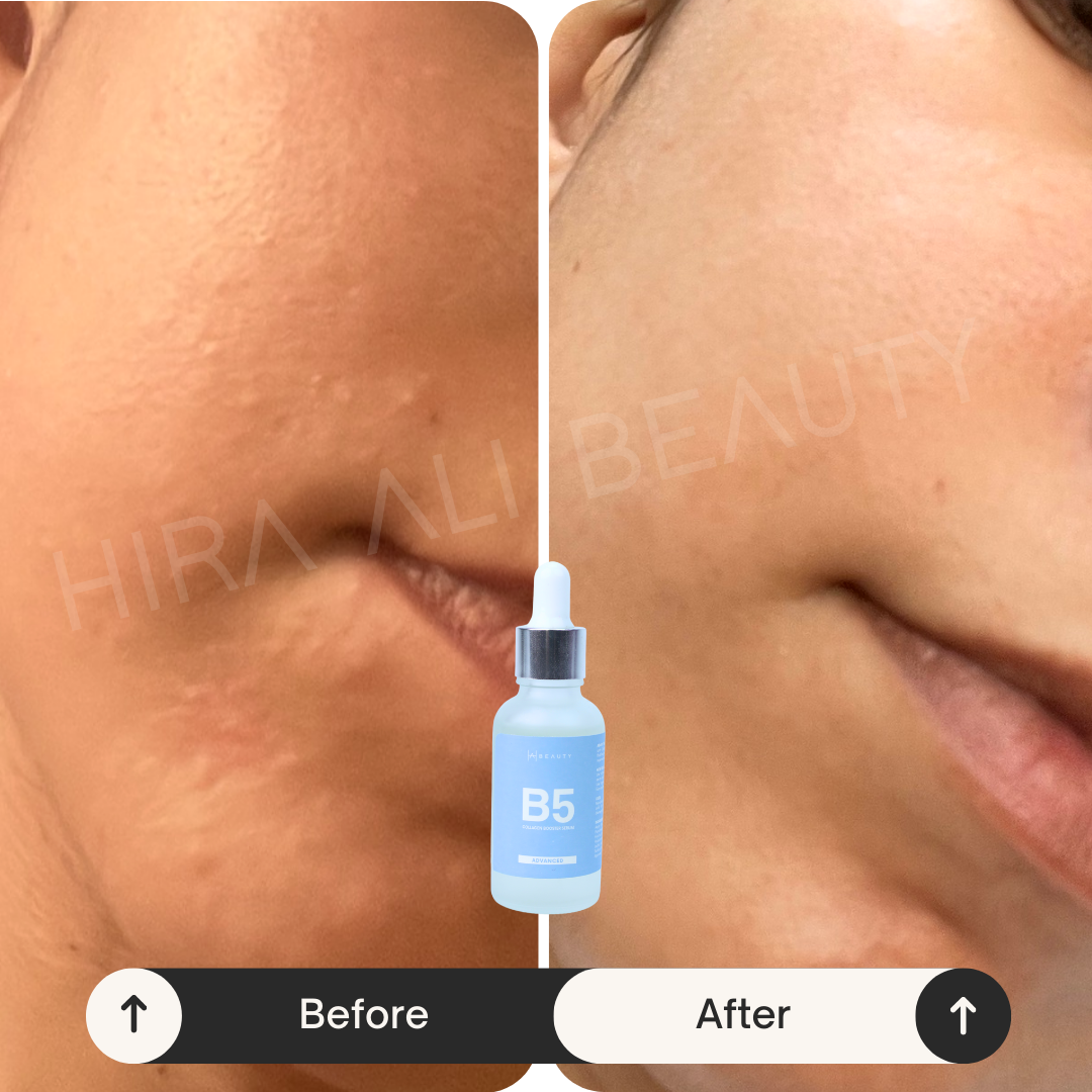 Collagen Booster Serum - Vit B5 + HA - Hira Ali 