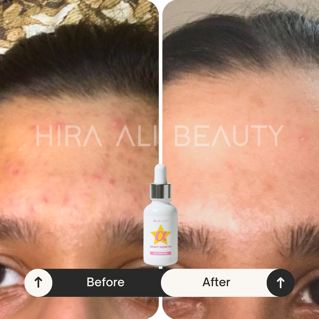 Brightening Protection Bundle