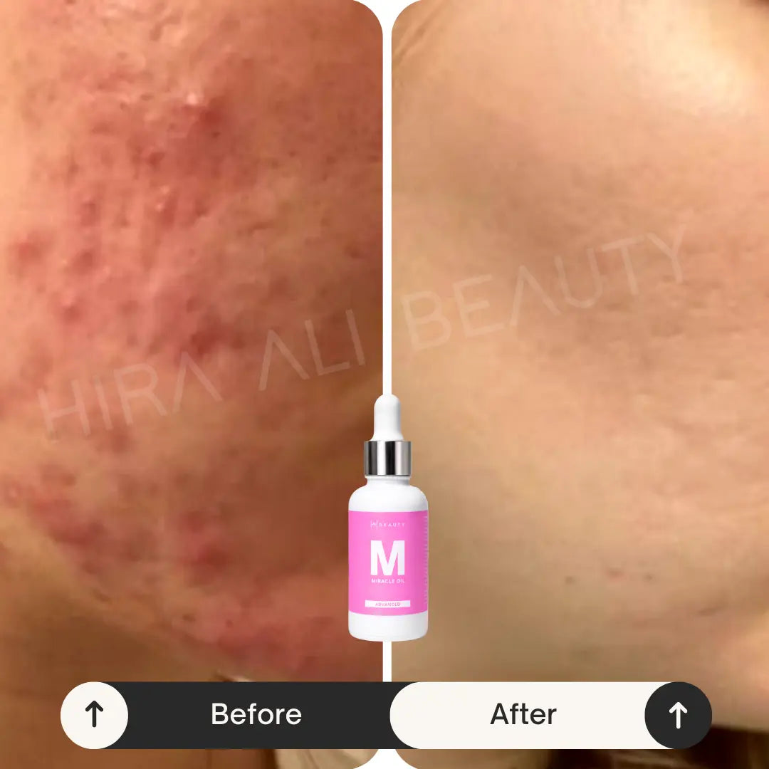 Miracle Oil Serum - Hira Ali 