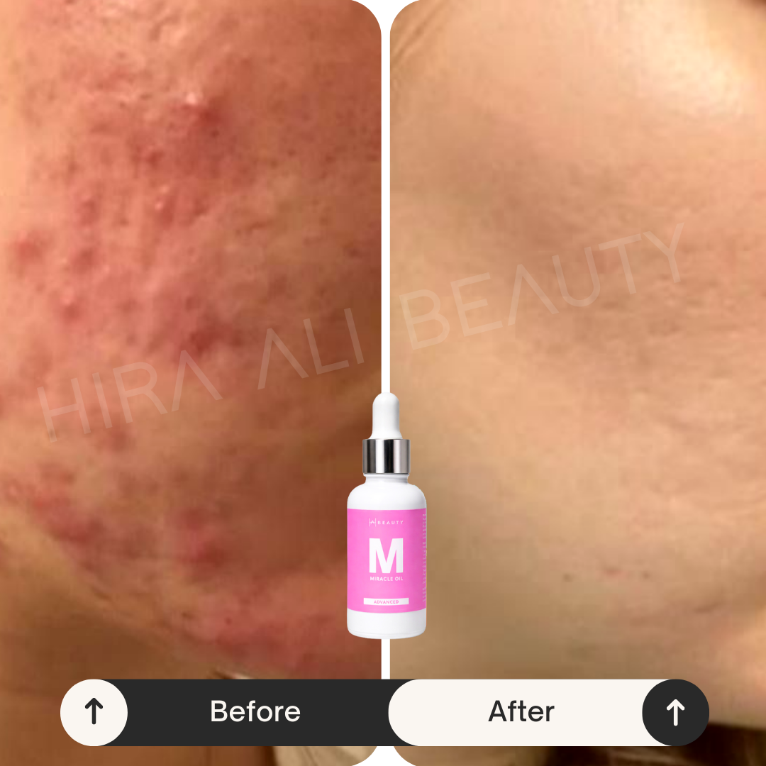 Miracle Oil Serum - Hira Ali 