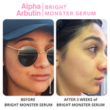 Alpha Arbutin 2% + HA - Bright Monster Serum - Hira Ali 