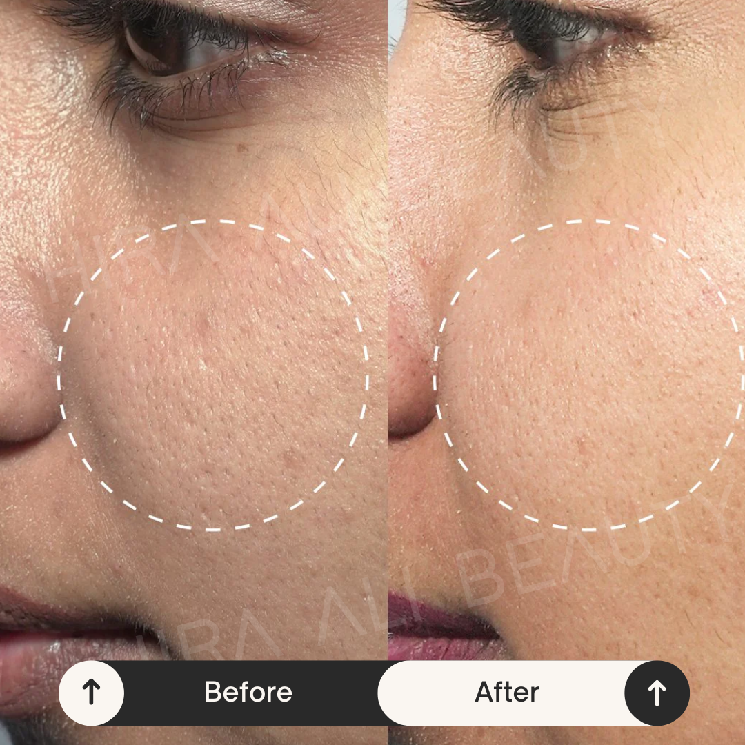 Pore Perfect Mask - Hira Ali 