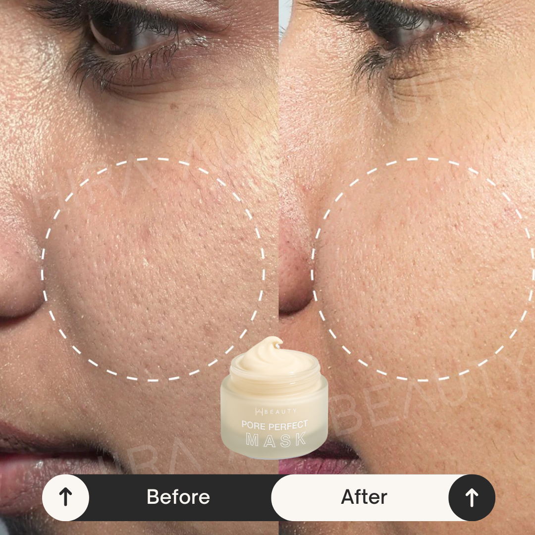 Perfect Pores Bundle
