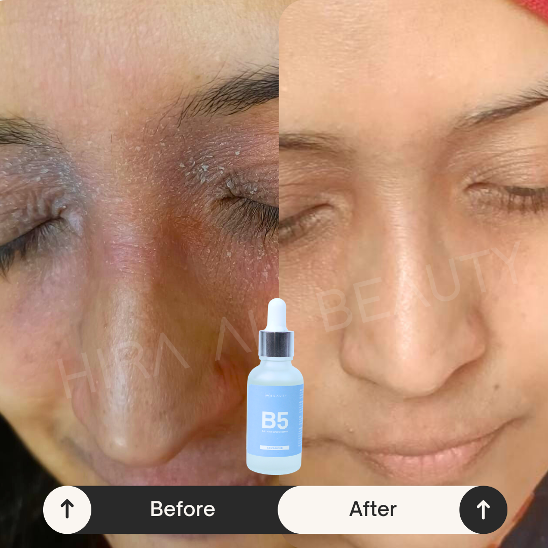Collagen Booster Serum - Vit B5 + HA - Hira Ali 