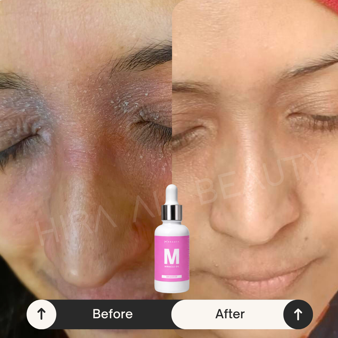 Miracle Oil Serum - Hira Ali 