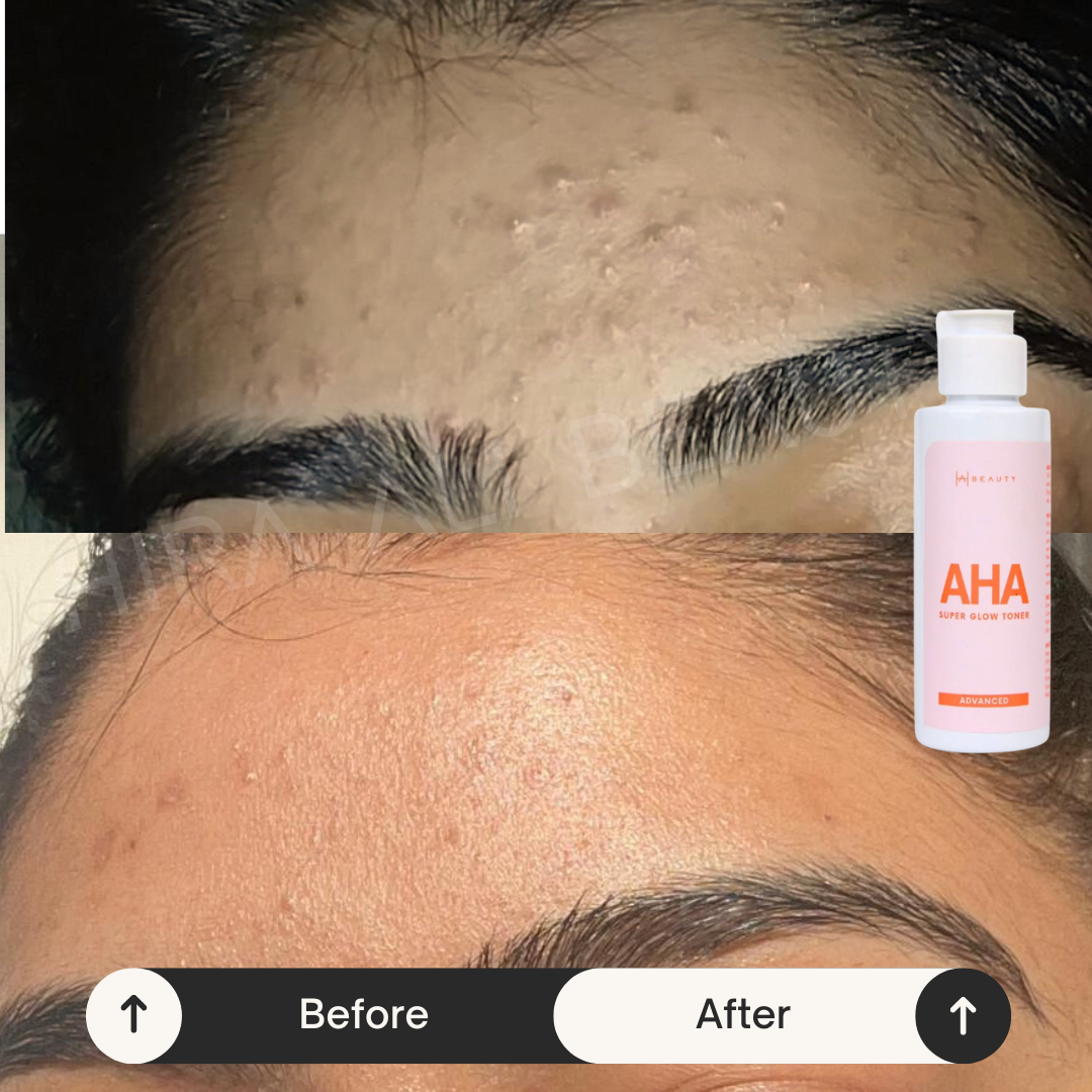 Exfoliation Duo - Hira Ali 