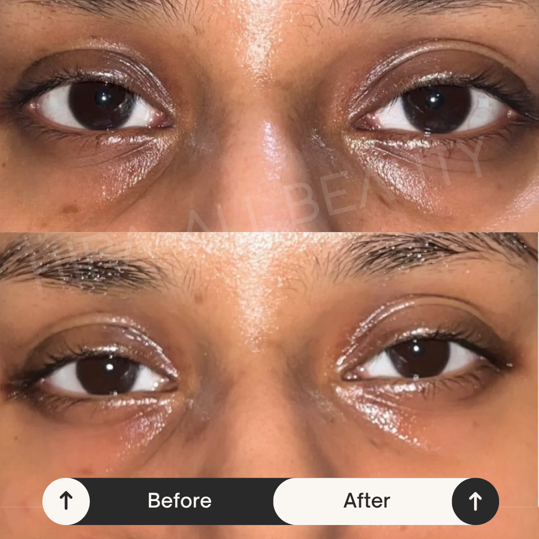 Eyespresso Under Eye Serum – Dark Circles + Puffiness - Hira Ali 