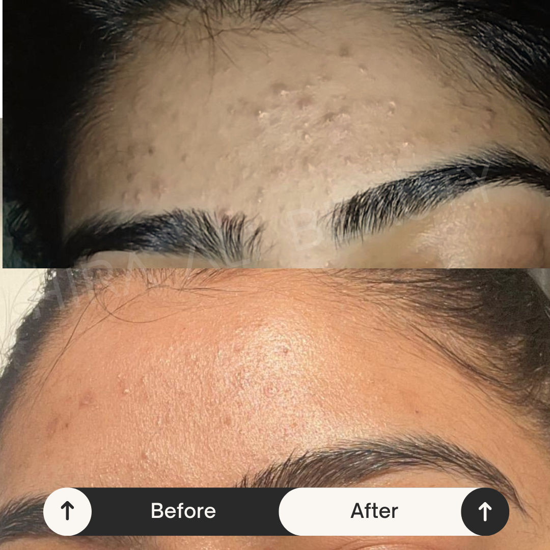 AHA Super Glow Toner - Hira Ali 