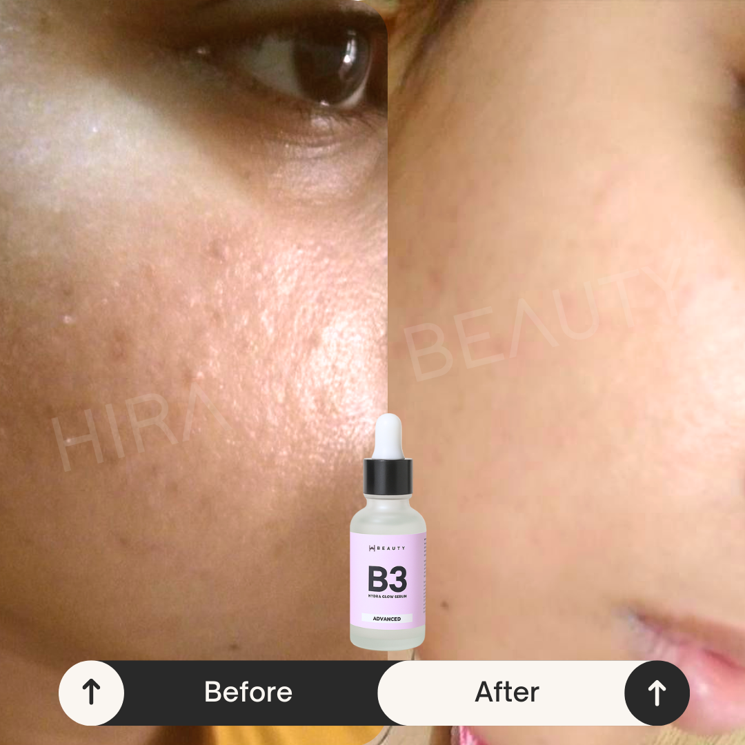 B3 Hydra Glow Serum - Niacinamide 10% + HA - Hira Ali 