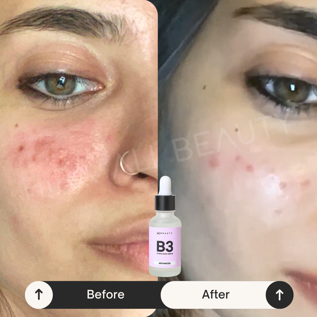 B3 Hydra Glow Serum - Niacinamide 10% + HA - Hira Ali 