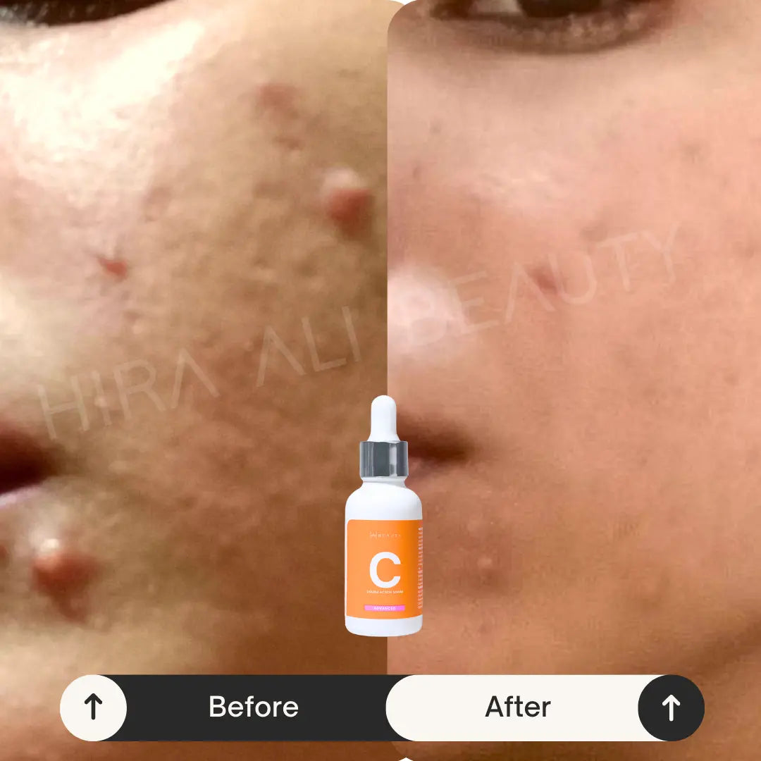 Double Action Serum - Vit C 10% + HA - Hira Ali 