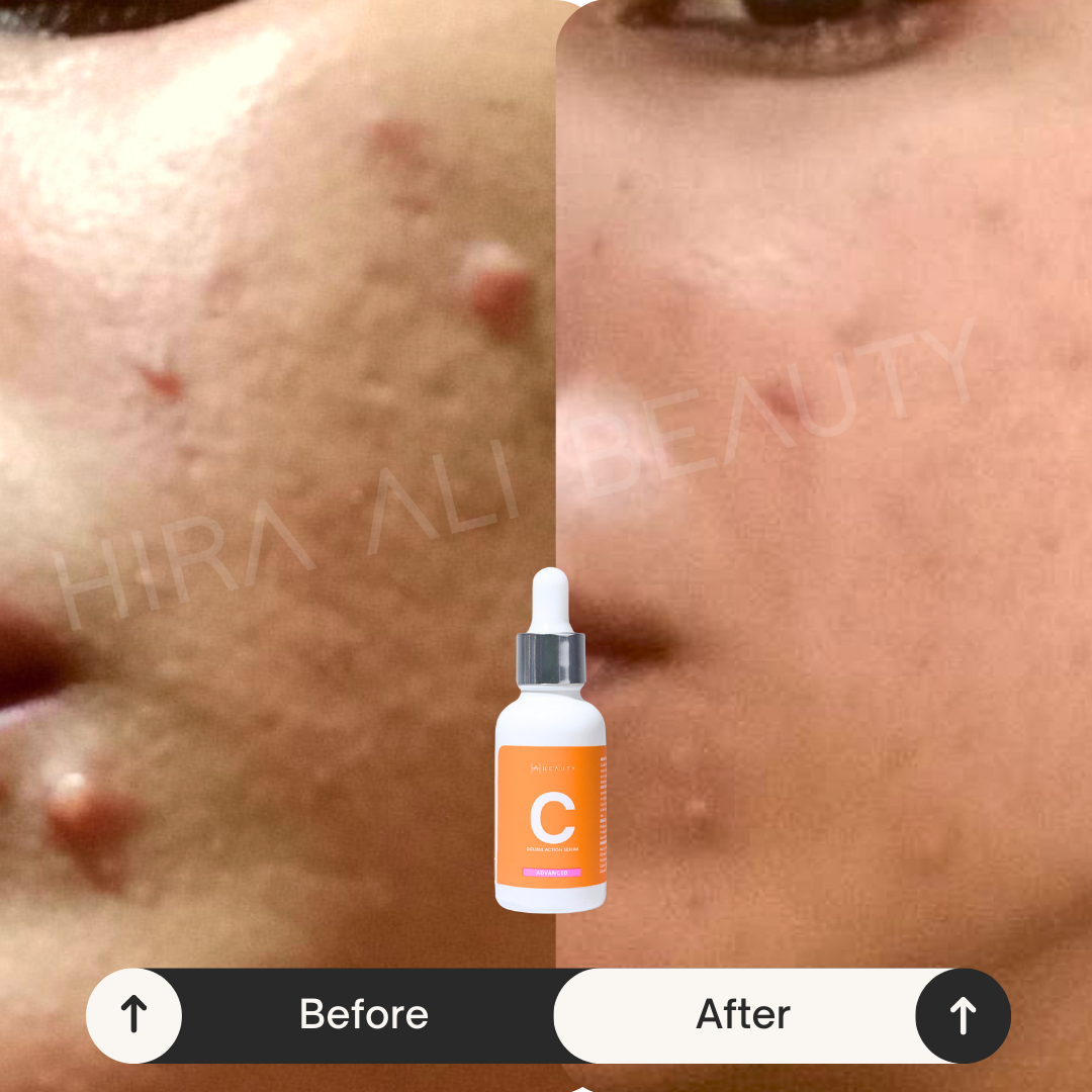 Double Action Serum - Vit C 10% + HA - Hira Ali 