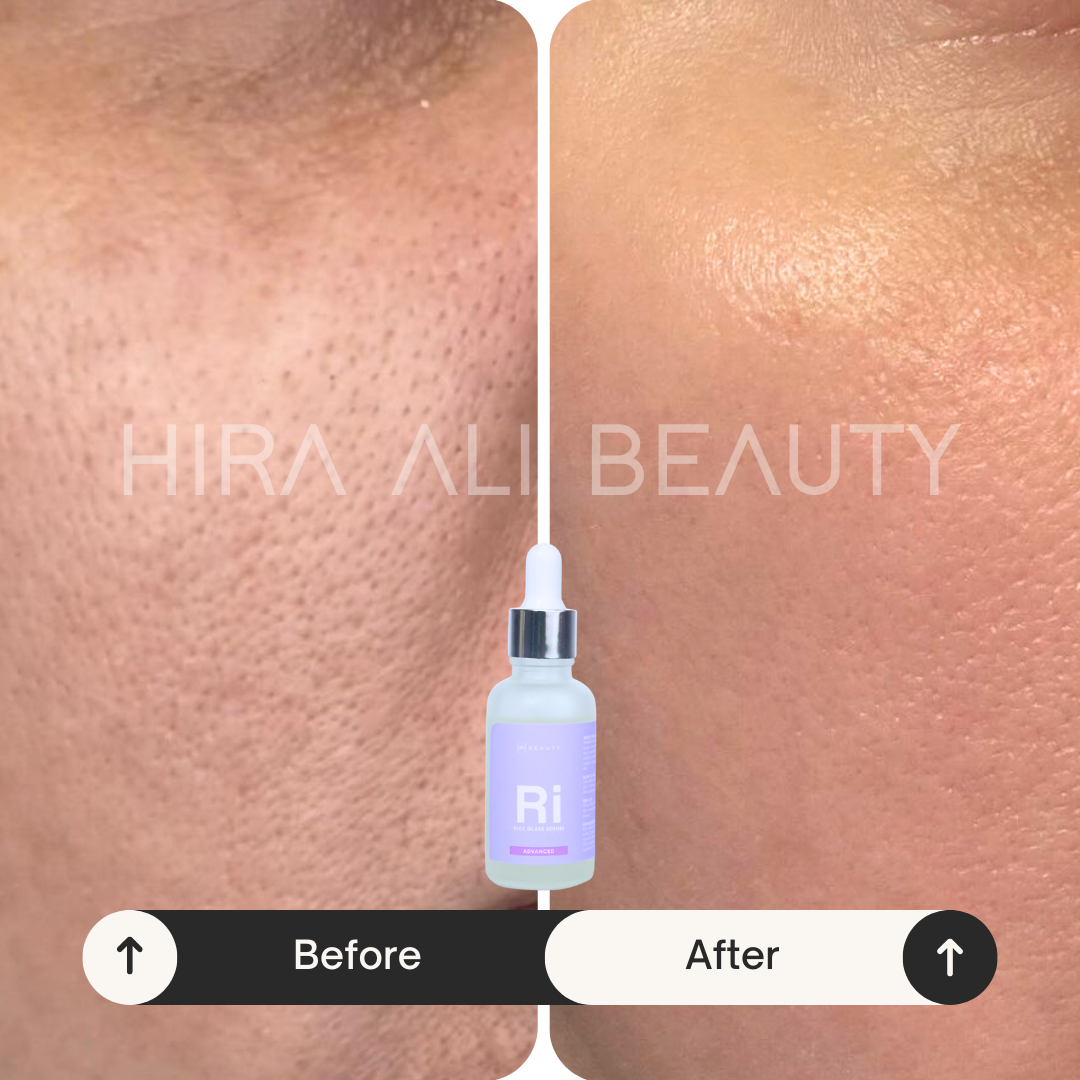 Rice Glass Serum - Hira Ali 