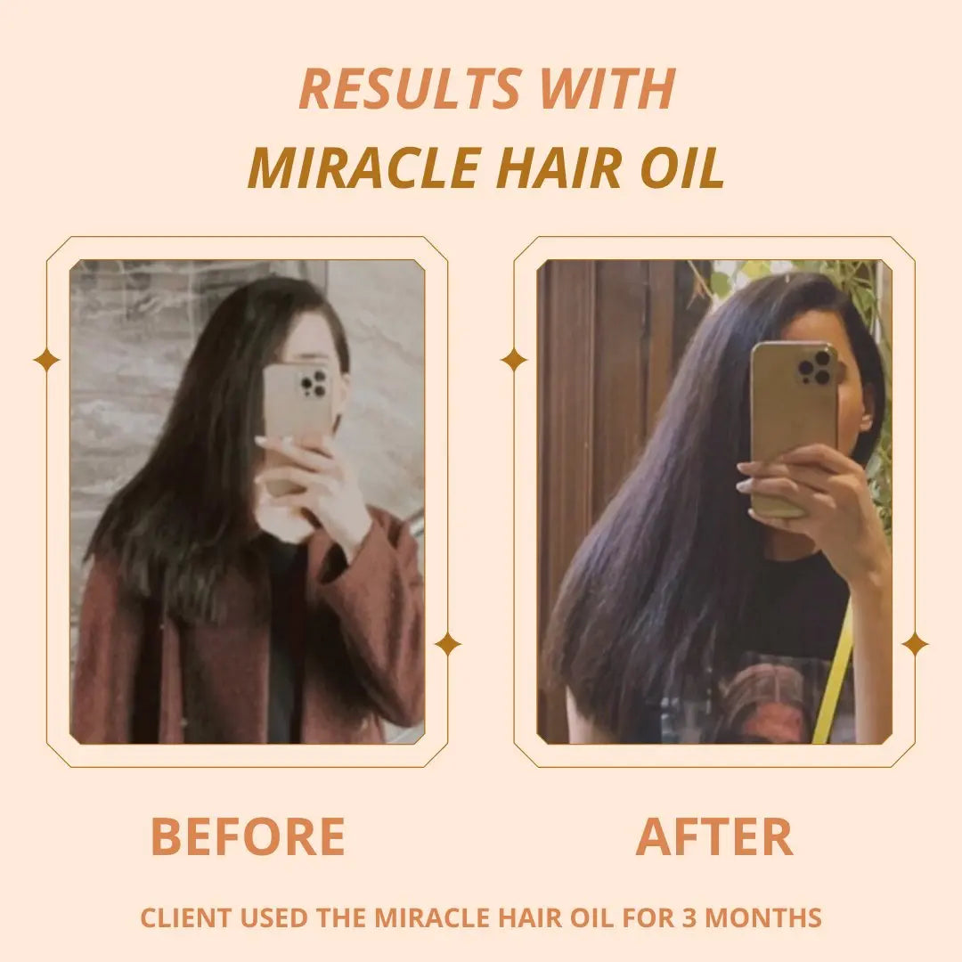 Miracle Hair Regrowth Oil - Hira Ali