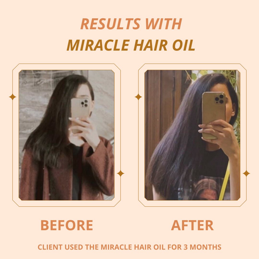 Miracle Hair Regrowth Oil - Hira Ali