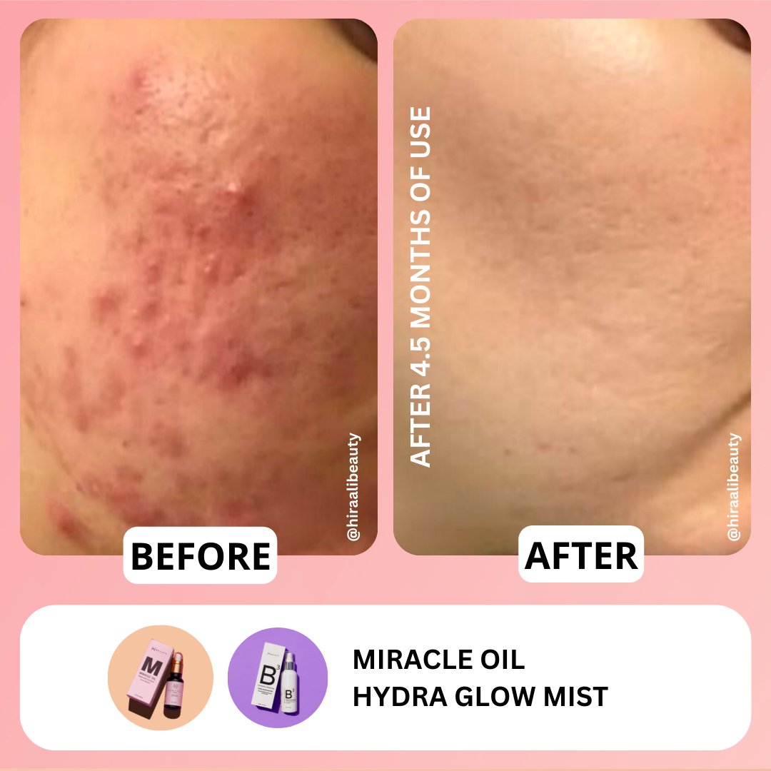 Miracle Oil Serum - Hira Ali