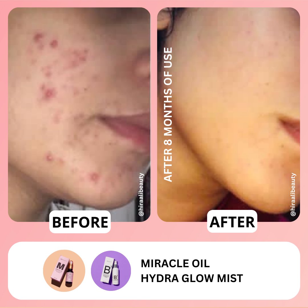 Miracle Oil Serum - Hira Ali