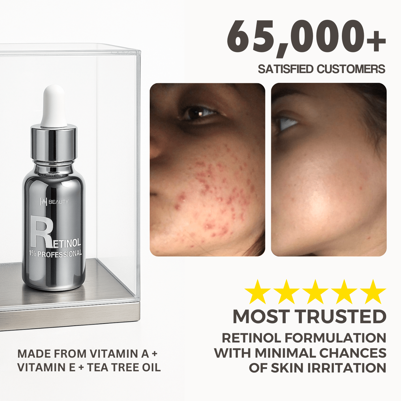 Retinol Pro Serum 1% - Hira Ali