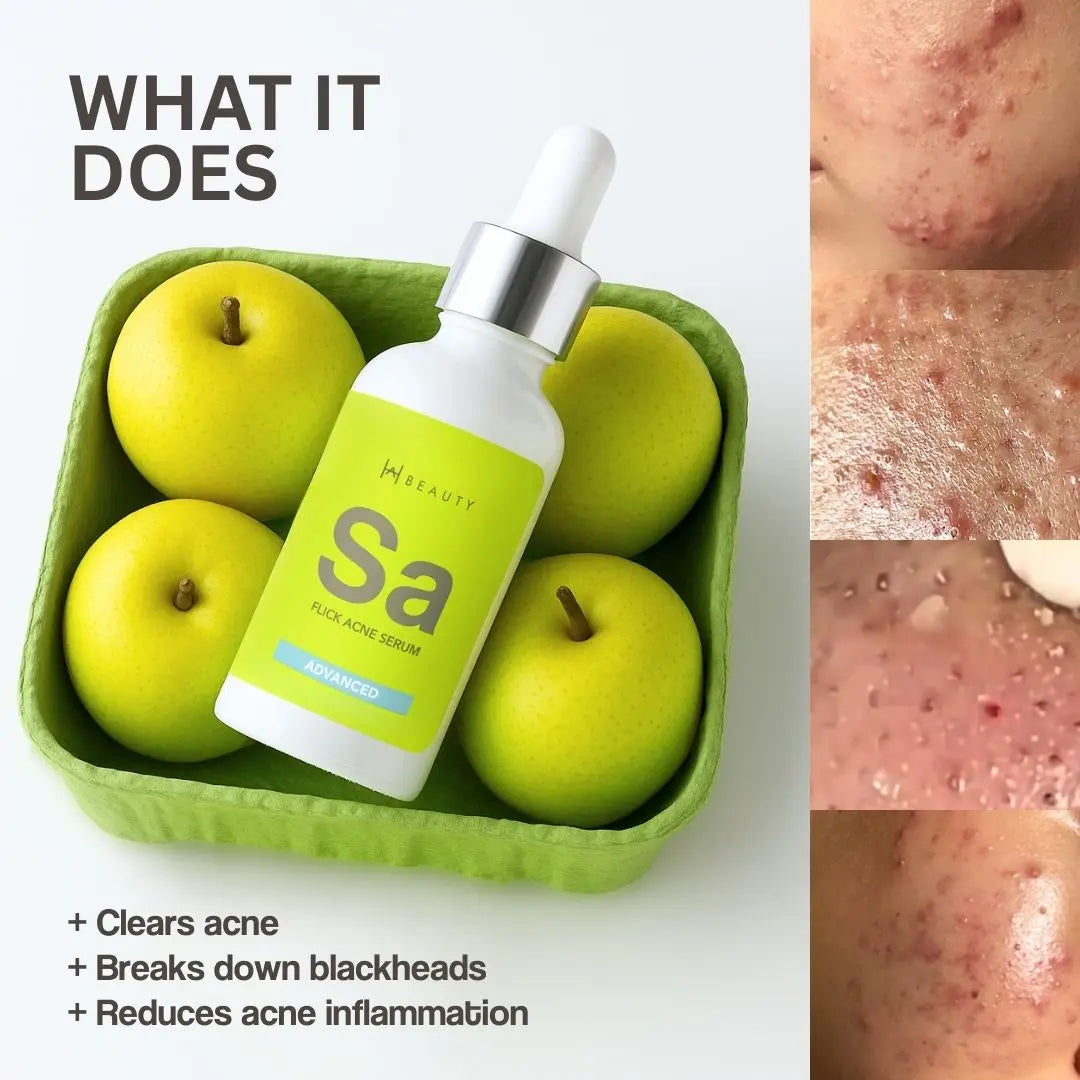 Salicylic Acid + Ivy Leaf - Flick Acne Serum. - Hira Ali