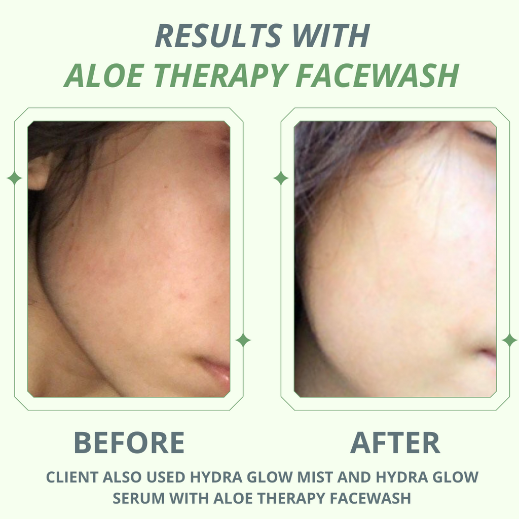 Aloe Therapy Facewash | Lactic Acid - Hira Ali 